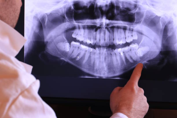 Best Emergency Dentist for Lost Fillings or Crowns in Henagar, AL